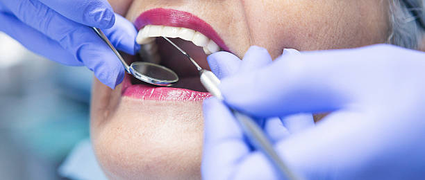 Best Emergency Dental Services for Seniors in Norwich, CT